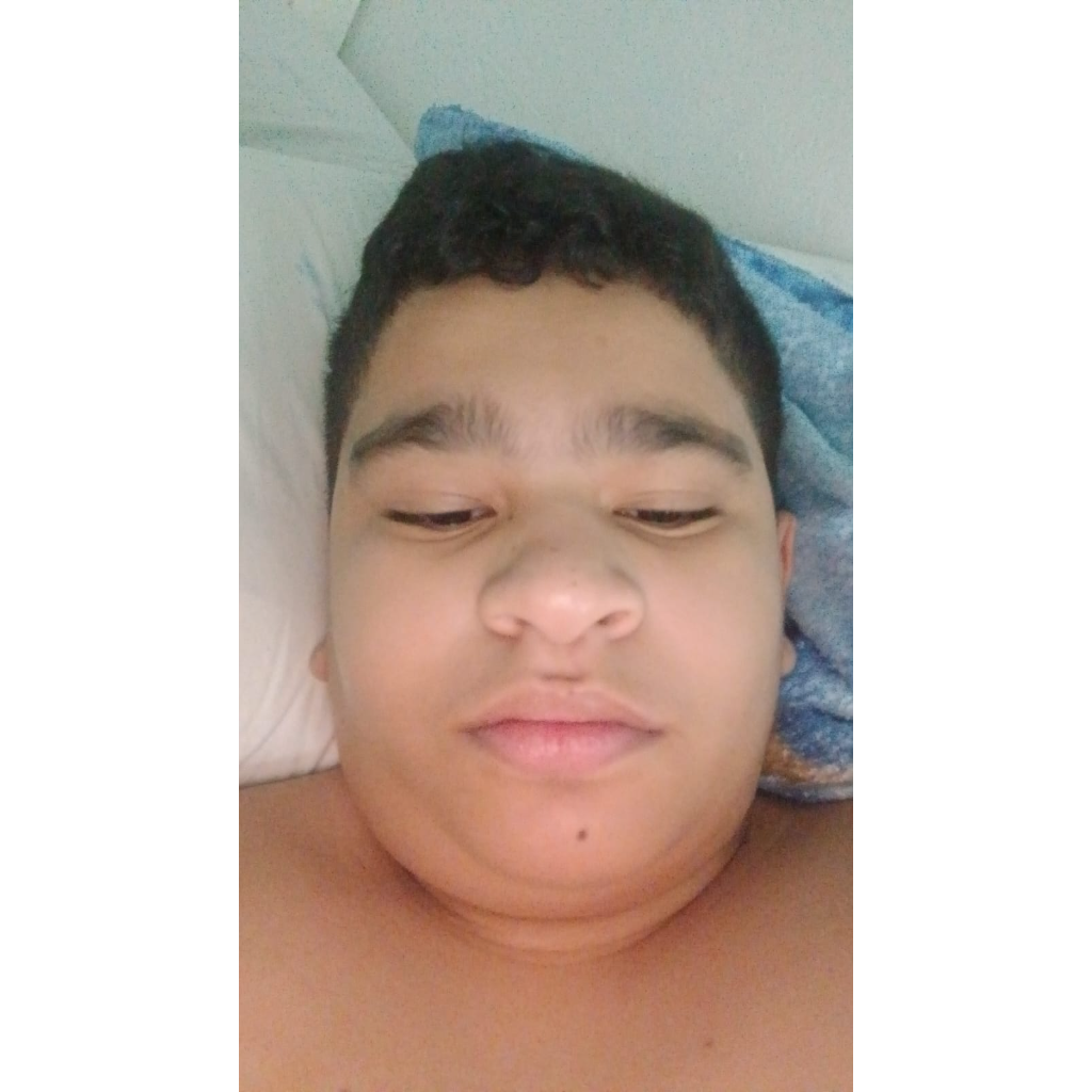 A person lies on a bed with their eyes closed, head resting on a pillow, against a white wall.